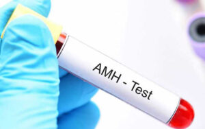 AMH Hormonu