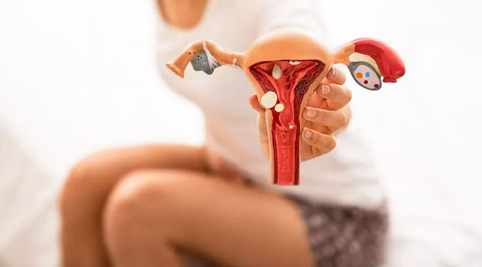 kıbrıs endometriozis tedavisi