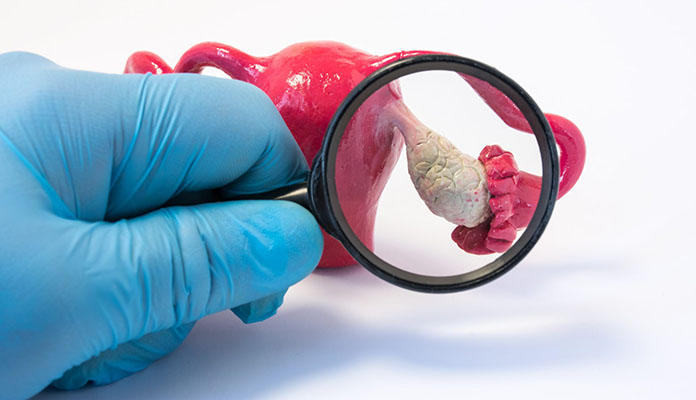 polikistik over sendromu tedavisi kıbrıs polikistik over sendromu tedavisi kıbrıs