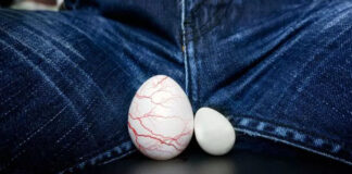 varikosel tedavisi kıbrıs