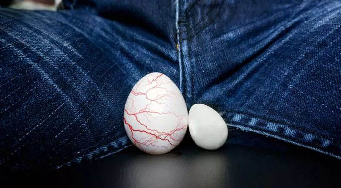 varikosel tedavisi kıbrıs varikosel tedavisi kıbrıs