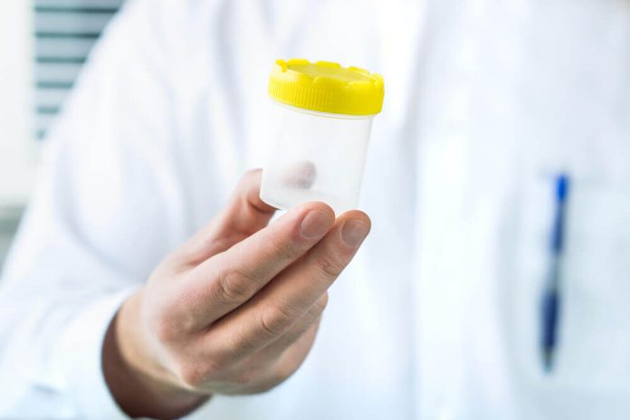 Sperm Testi Analizi ve Tedavi Secenekleri Sperm-Testi-Analizi-ve-Tedavi-Secenekleri.