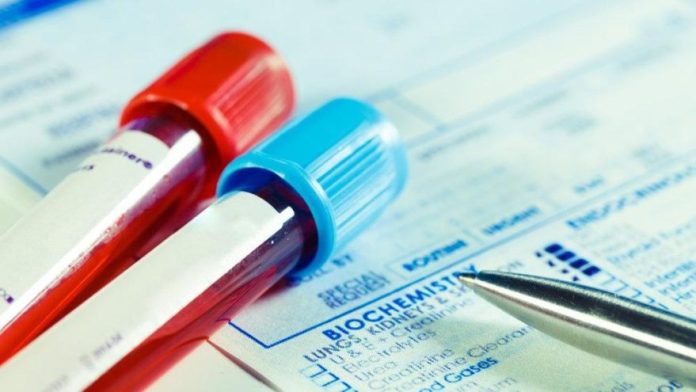 AFP Testi (Alfa FetoProtein) Nedir